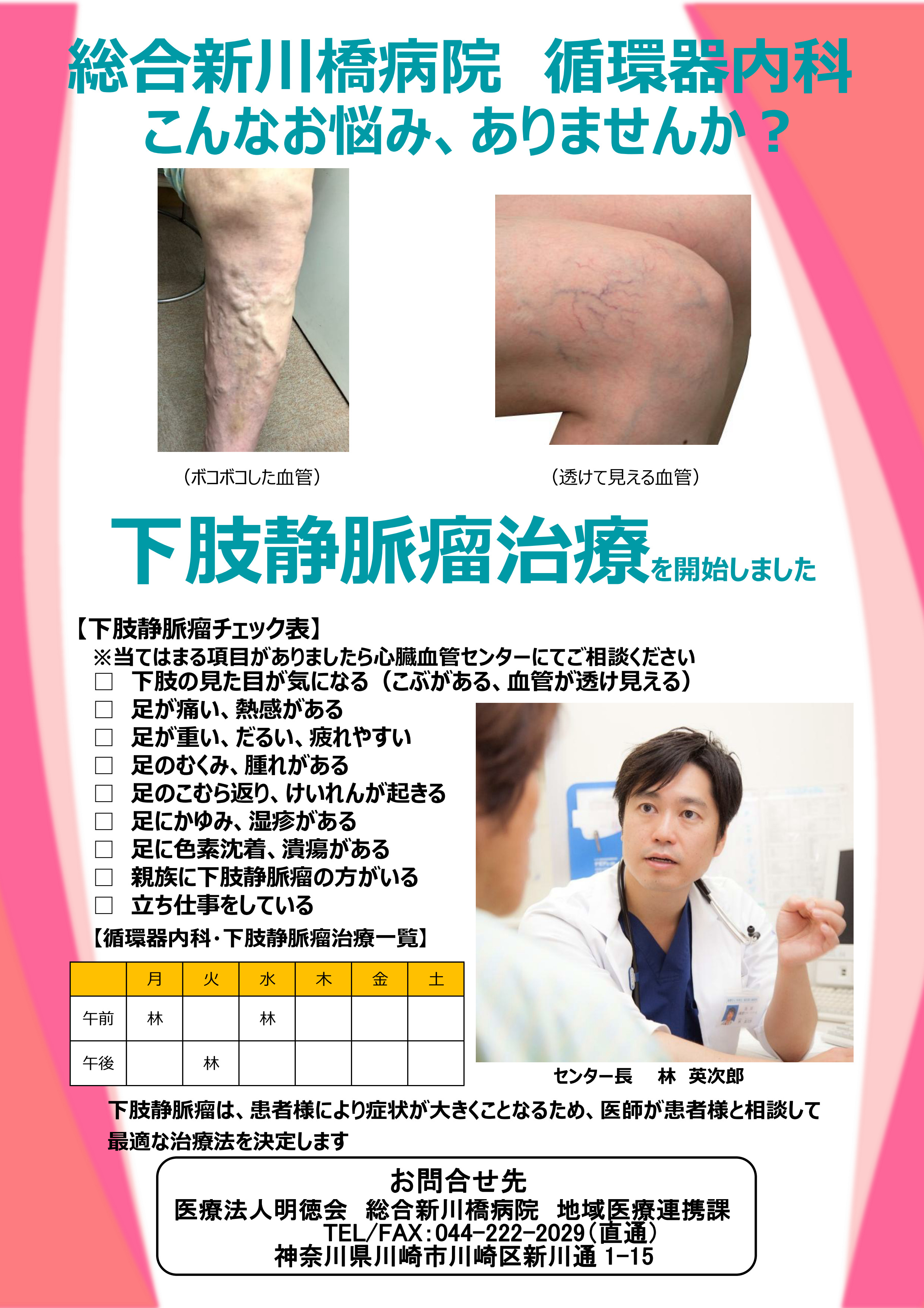 下肢静脈瘤治療を開始しました